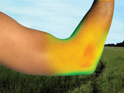Elbow Brace
