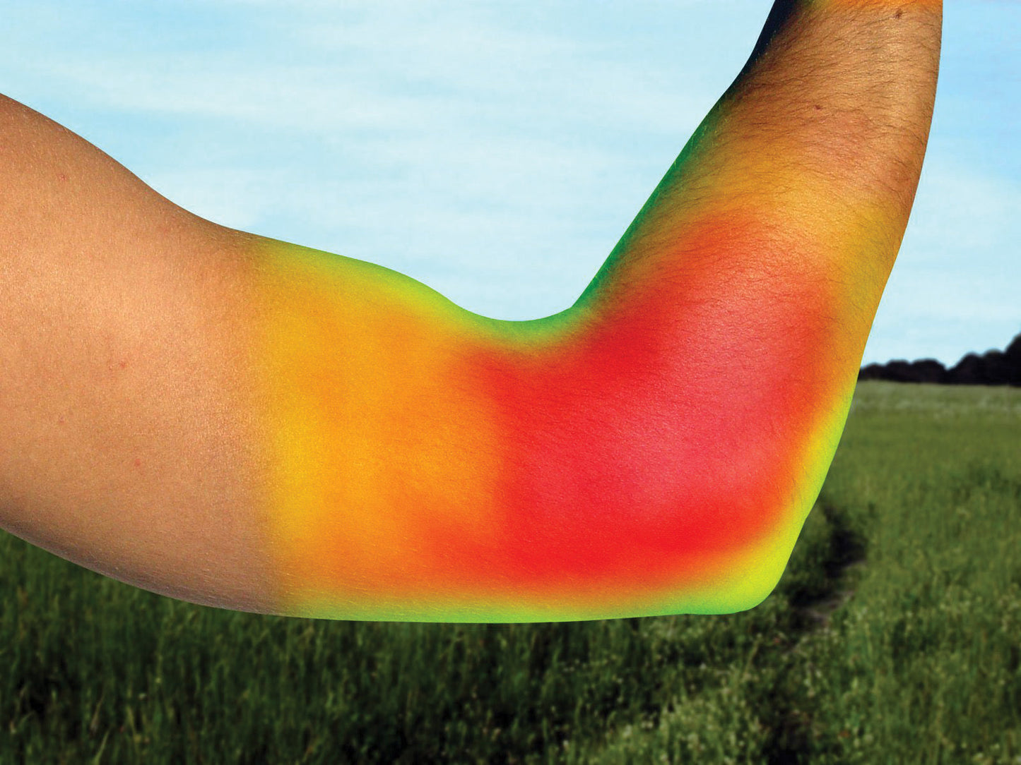 Elbow Brace